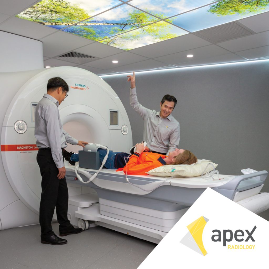 Apex MRI with Mirrors to help with MRI claustrophobia